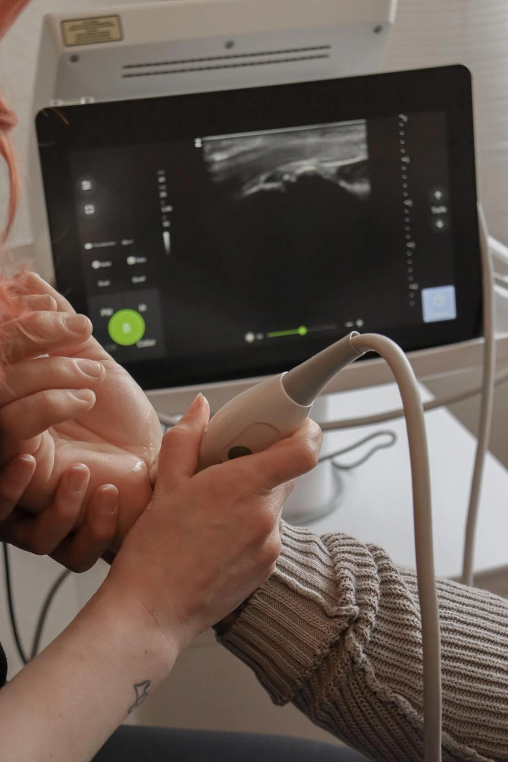 LPZ-Hübner - Physiotherapie und Lymphdrainage - Eine medizinische Fachkraft scannt mit einer handgeführten Ultraschallsonde das Handgelenk einer Person, während auf einem digitalen Monitor im Hintergrund ein Schwarz-Weiß-Sonogramm des inneren Gewebes angezeigt wird.